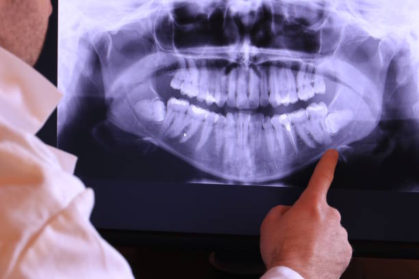 Best Emergency Tooth Extraction in Rossford, OH
