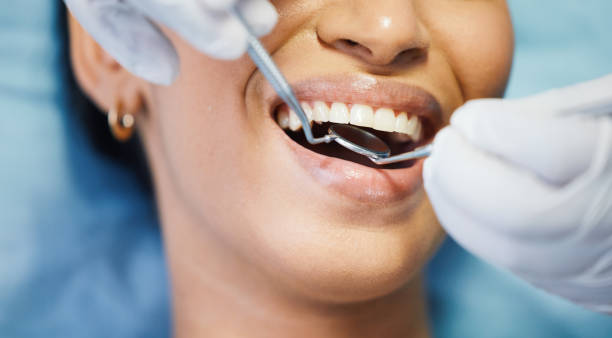 Best Urgent Care for Lost Fillings or Crowns in Rossford, OH